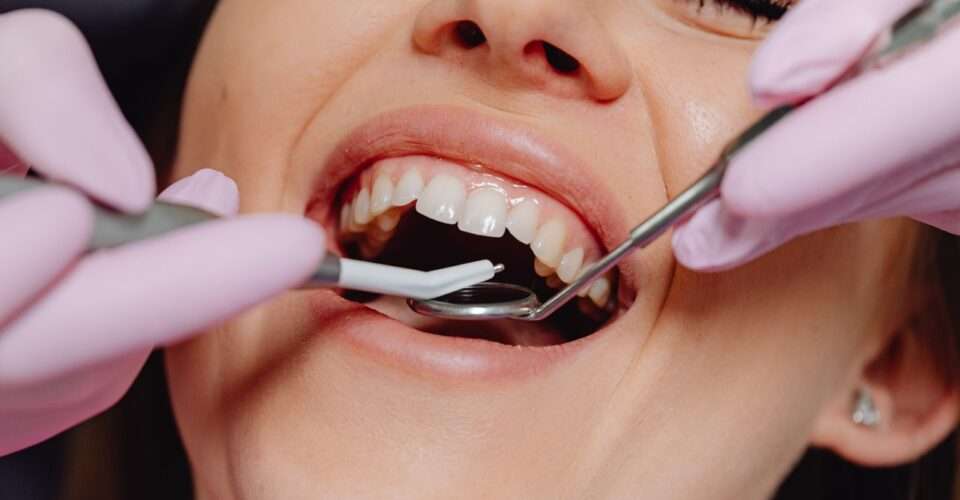 Best Orthodontics Clinic & Dentist in Dubai | Orthodontic Dental Clinic