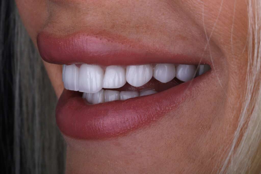 Cosmetic Dentistry