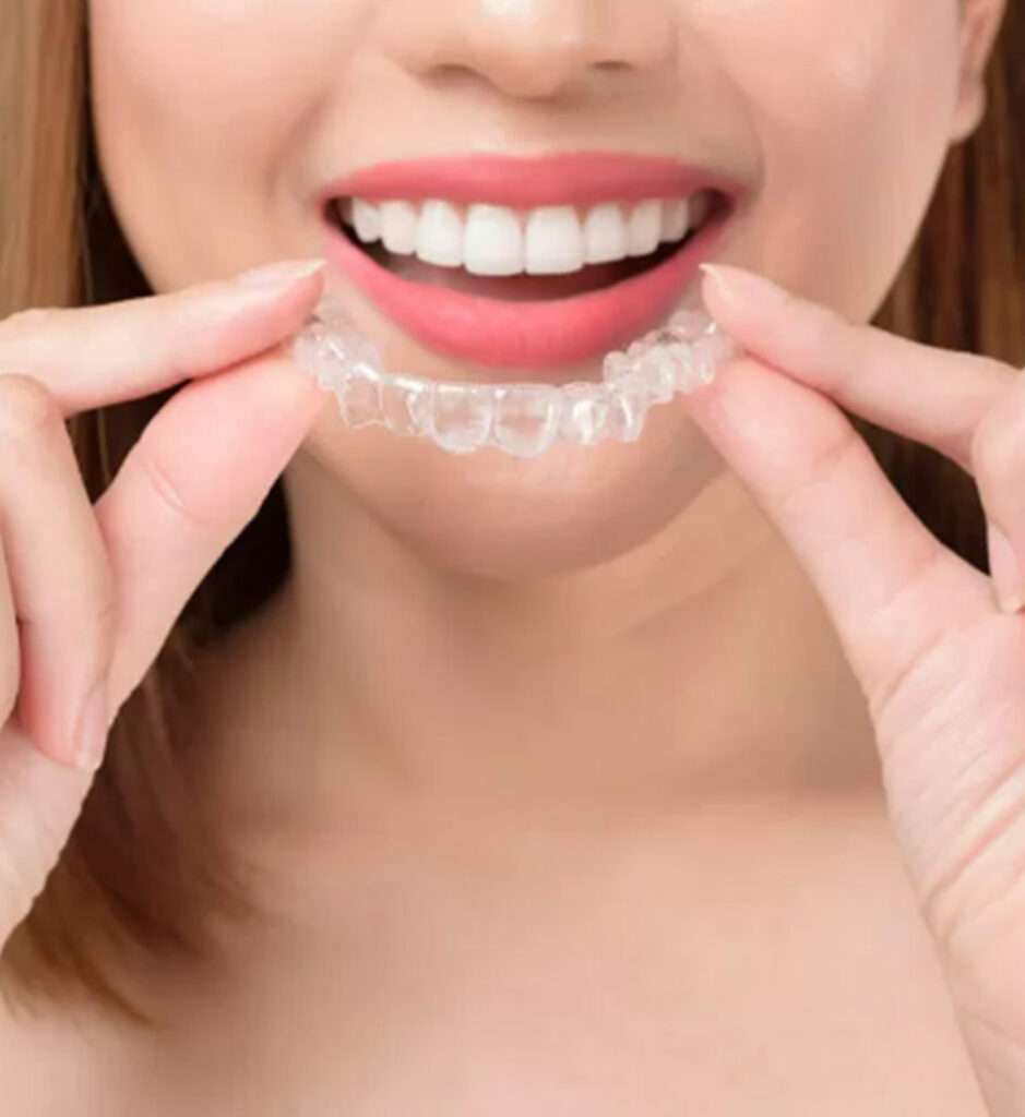 Get Faster results with Invisalign