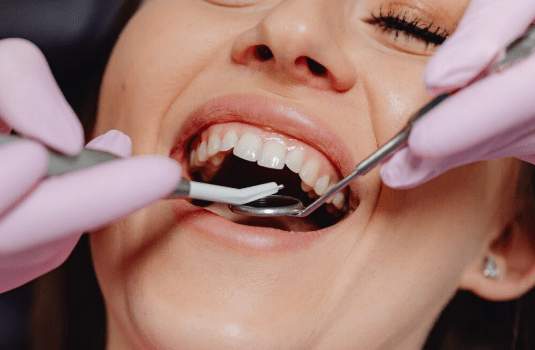 Laser Gingivectomy Healing Period