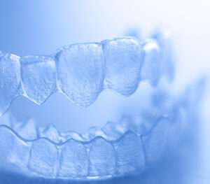 he best Dental Clinic in Dubai to Get Invisalign Braces