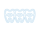 Teeth-Braces