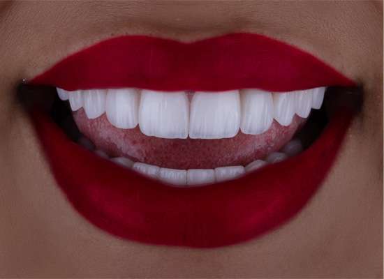 3 D Hollywood Smile